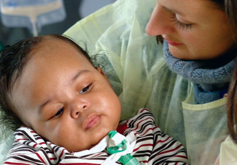 Close up of a baby with a tracheotomy being held by a healthcare worker.